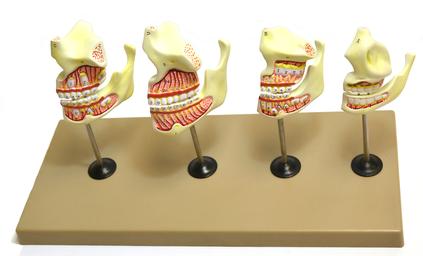 Eisco Labs Dentition Model - 4 Stages; 8 Pieces