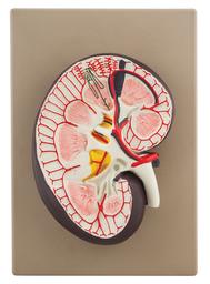 Human Kidney Cross Section Model - 3X Life Size - Eisco Labs