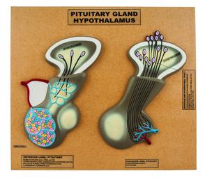 Eisco Labs Model of Pituitary Gland and Hypothalamus; Greatly Enlarged: