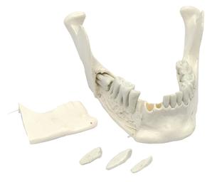 Lower Jaw Model, 16 Extractable Teeth - Anatomically Accurate Human Bone Replica - Natural Size, Natural Color - Eisco Labs