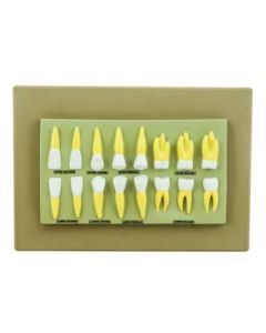 Eisco Labs Human Teeth Anatomical Model, Set of 16, 2 Times Life Size