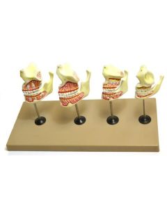 Eisco Labs Dentition Model - 4 Stages; 8 Pieces