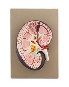 Human Kidney Cross Section Model - 3X Life Size - Eisco Labs