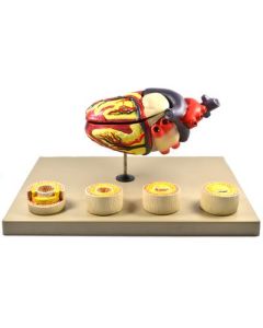 Eisco Labs Model of Human Heart Conditions Pathology; Larger than life size (10"); Artery Cross sections 2.5" in diameter