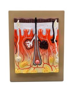 Human Skin Model, 300x Enlarged - with Hand Painted Details - Mounted on Base, 13" x 10" - Eisco Labs