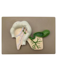 Human Pancreatic Duct Model, Three Dimensional, with Hand Painted Details - Mounted on Base, 10" x 7" - Eisco Labs