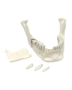 Lower Jaw Model, 16 Extractable Teeth - Anatomically Accurate Human Bone Replica - Natural Size, Natural Color - Eisco Labs
