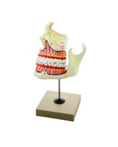 Eisco Labs Upper and Lower Jaw - 4 Times Enlarged - Mounted on stand