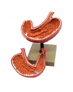 Human Stomach Model, 2 Parts, Three Dimensional, Sectional View with Hand Painted Details - Mounted on Base, 5" x 5" x 7.5" - Eisco Labs