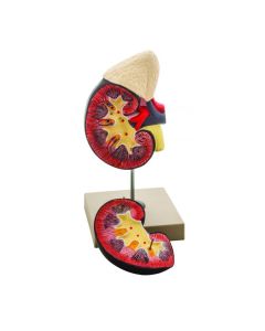 EISCO Human Kidney with Adrenal Gland Model, 2 Parts - Hand Painted