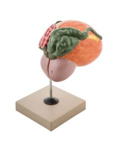 Eisco Labs Human Urinary Bladder with Prostate Anatomical Model, 2 Parts, 3 Times Life Size, Approx. 8"x8"x6"