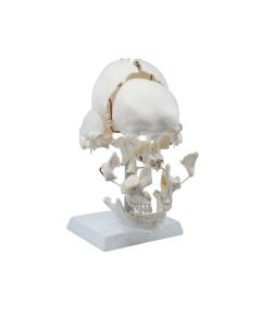 Beauchene Exploded Skull Model - 13 Parts - Life Size - Mounted on Articulated Stand - Eisco Labs