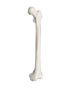 Femur Bone Model - Left - Anatomically Accurate Human Femur Bone Replica - Eisco