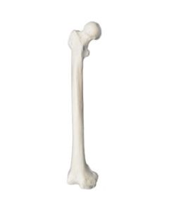 Femur Bone Model - Right - Anatomically Accurate Human Femur Bone Replica - Eisco