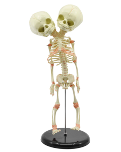 Infant skeleton (fetus skeleton), twin-skull