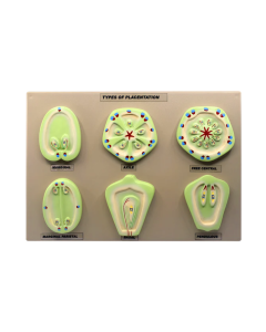 Model Placentation - Set of 6