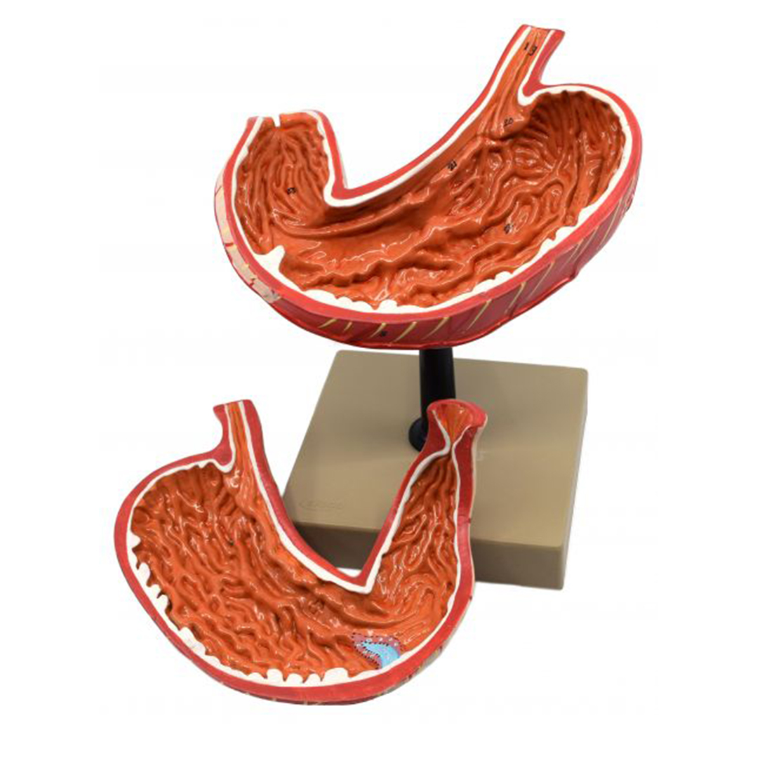 Human Stomach Model, 2 Parts, Three Dimensional, Sectional View with Hand Painted Details - Mounted on Base, 5