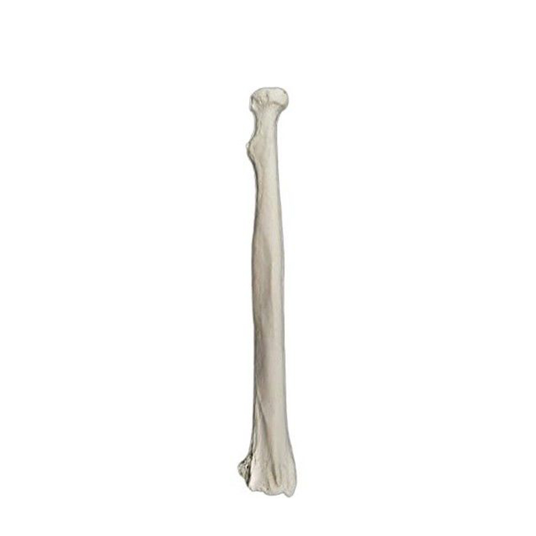 Radius Bone Model - RIGHT - Anatomically Accurate Human Radial Bone Replica - Eisco